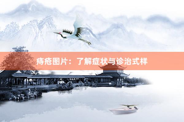 痔疮图片：了解症状与诊治式样